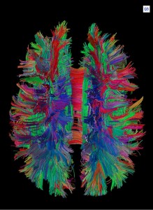 White matter fibre pathways of the brain as depicted with MR tractography. (Provided by Patric Hagmann, CHUV-UNIL, Lausanne, Switzerland)