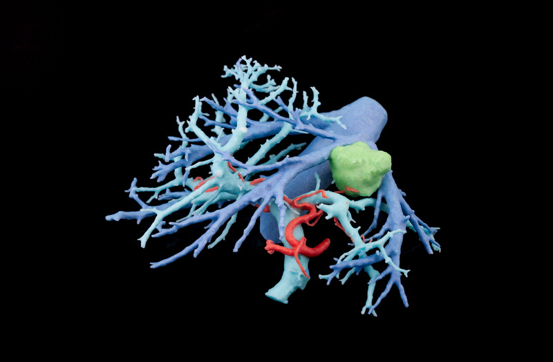 3D-printed liver vasulature