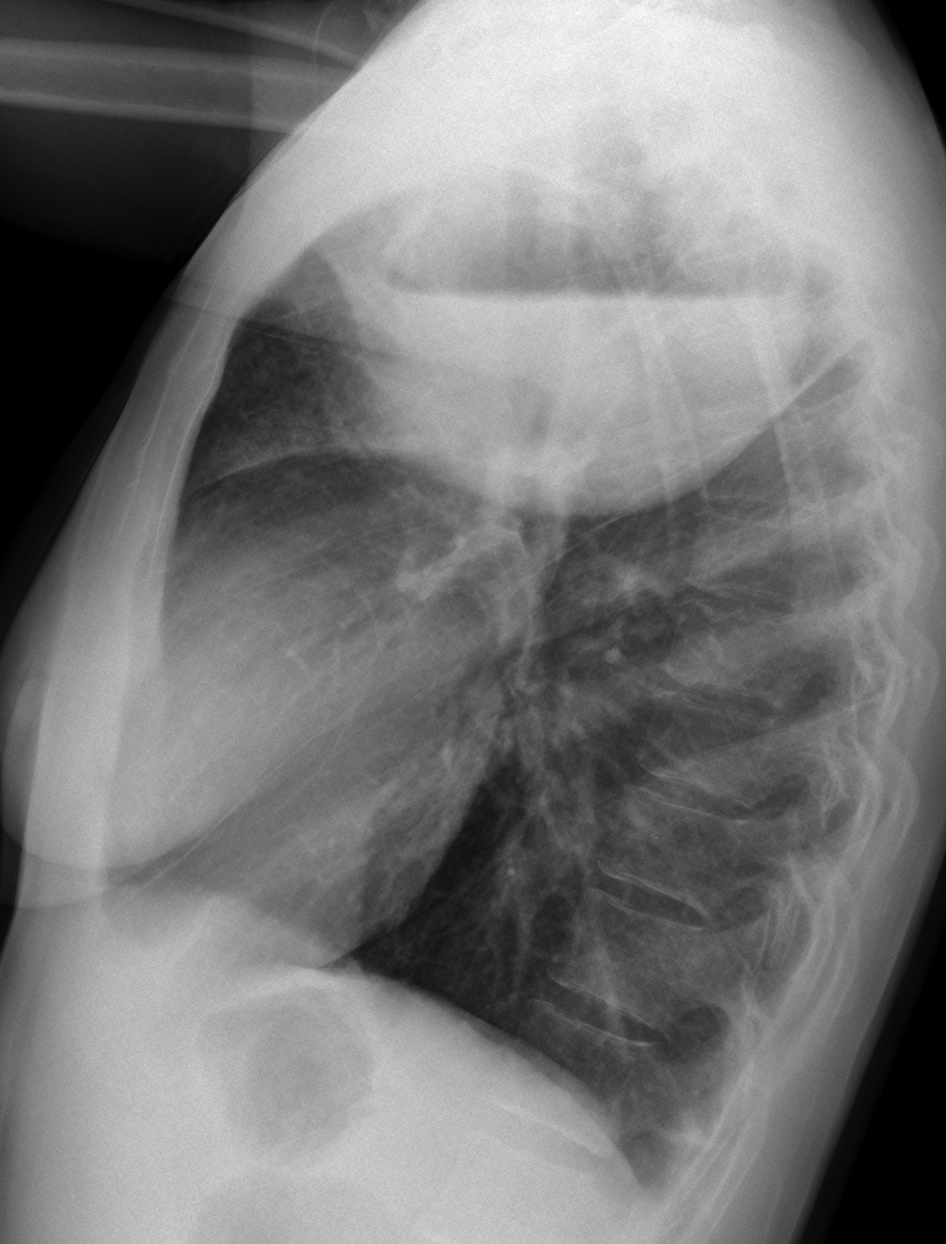 42-year-old woman, lateral chest