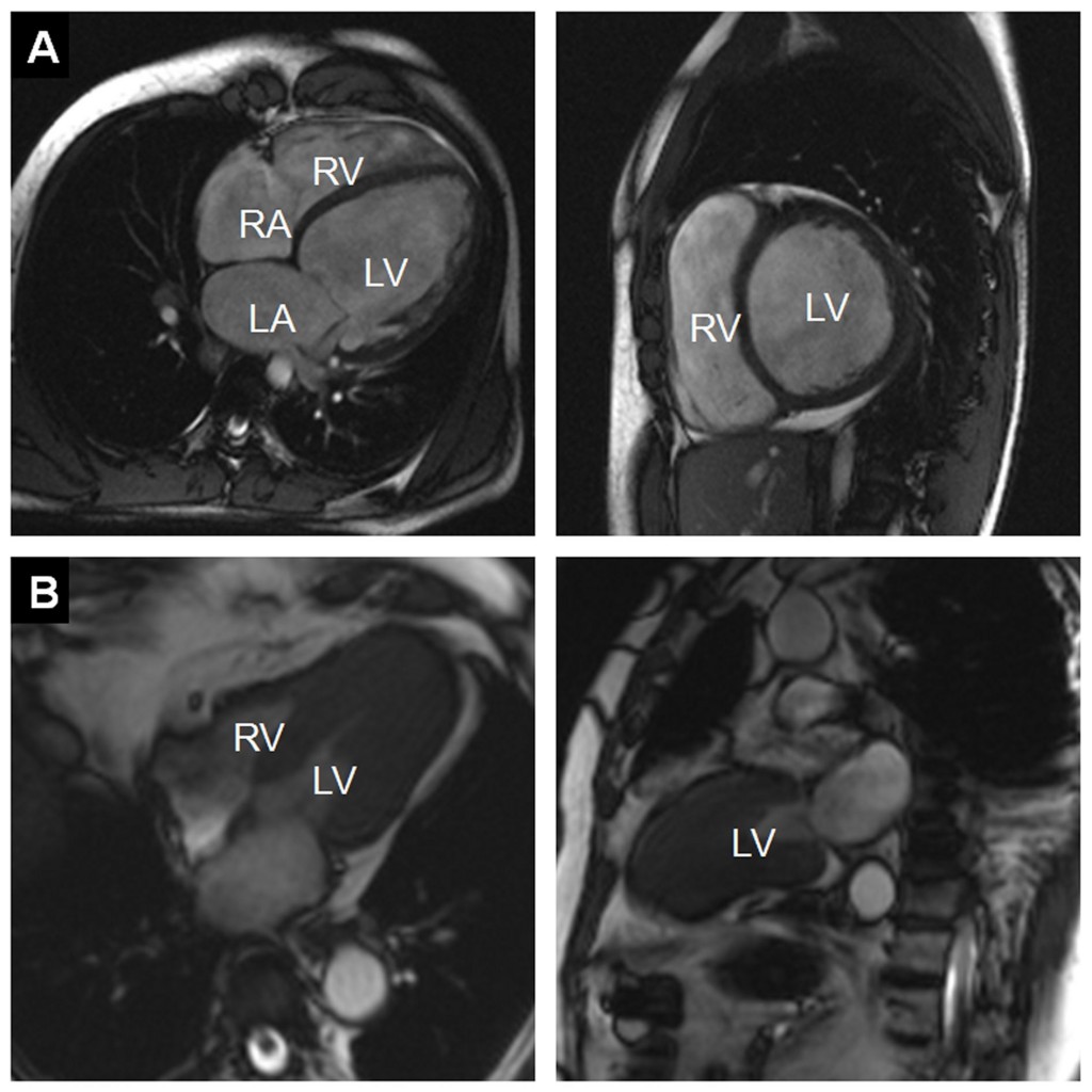 ECR 2013 Focus: Organs From A To Z: Heart | Blog