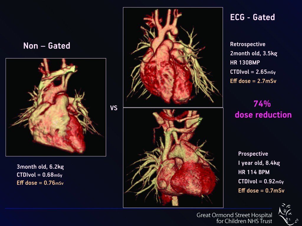 Paediatric MDCT  Chest Imaging Techniques