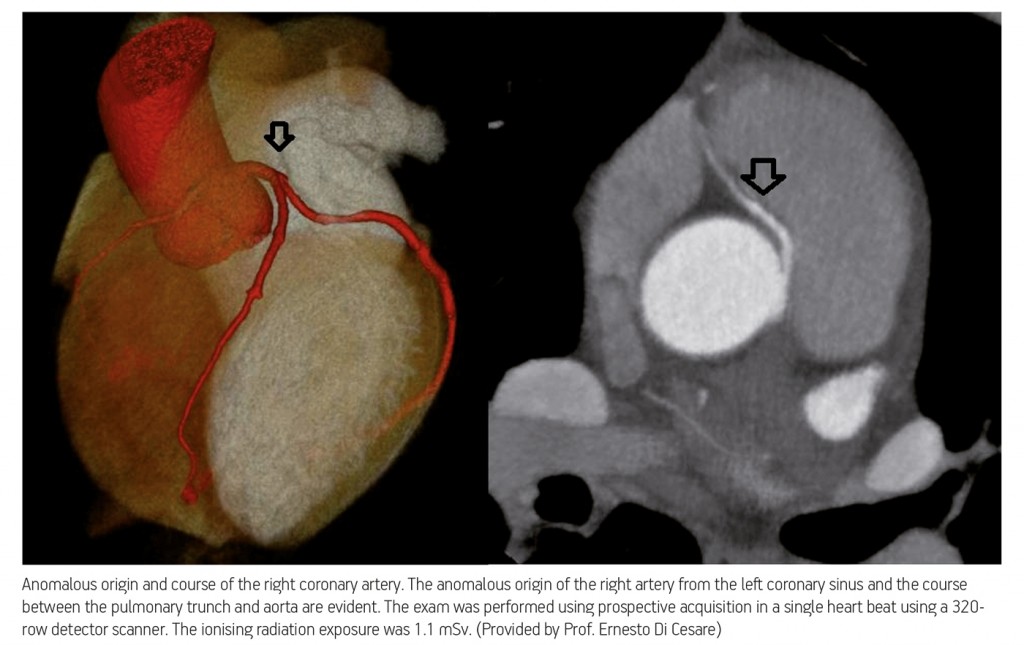 ECR_2013_ECRToday_CardiacImaging_1