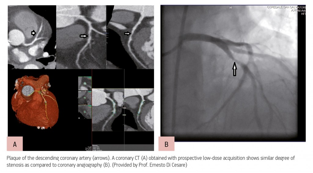 ECR_2013_ECRToday_CardiacImaging_2