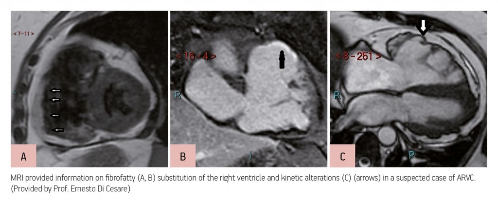 ECR_2013_ECRToday_CardiacImaging_3