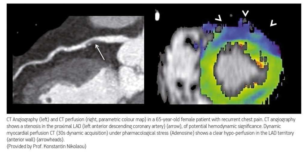 ECR_2013_ECRToday_CardiacImaging_4