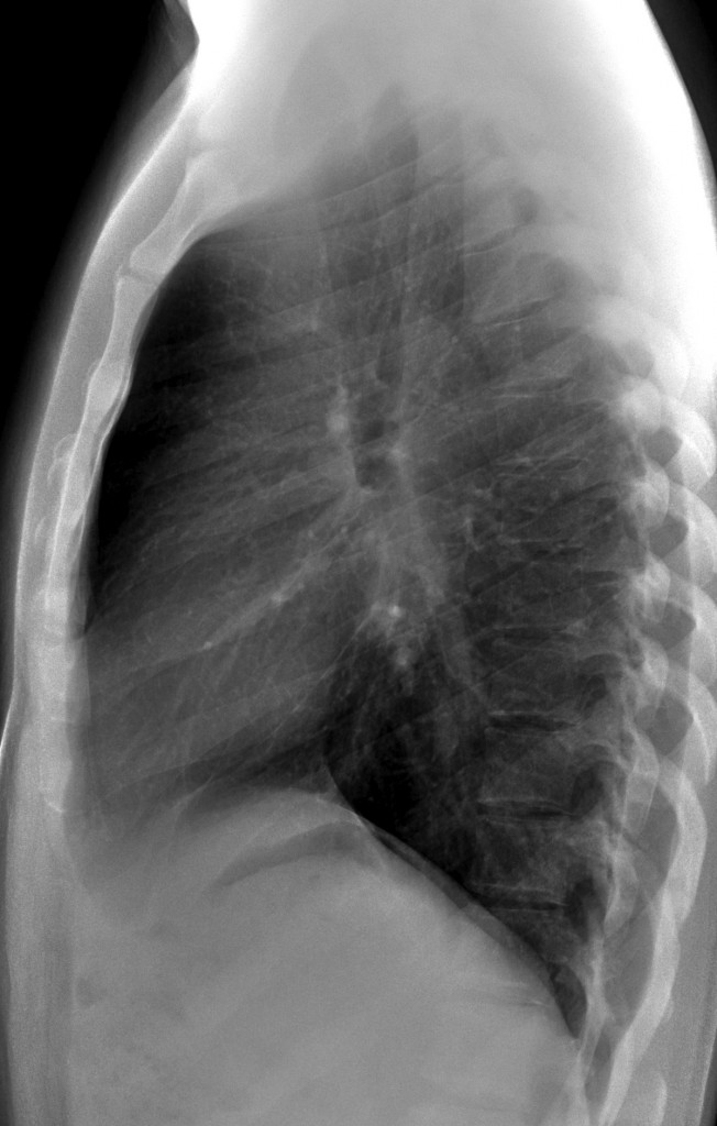29-year-old, lateral chest
