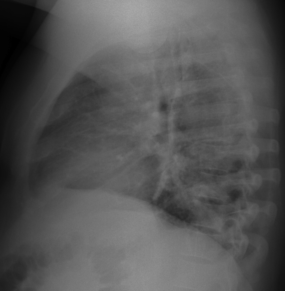41-year-old male, lateral chest