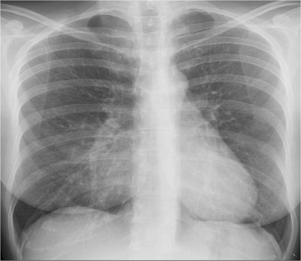 CASE 1: 27-year-old woman with moderate cough