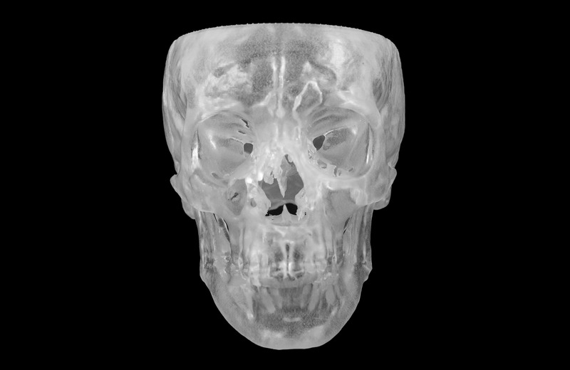 3D-printed skull